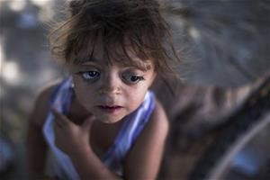 Camila Veron, 2, born with multiple organ problems and severely disabled, stands outside her home in Avia Terai, in Chaco province, Argentina.   (AP Photo/Natacha Pisarenko)